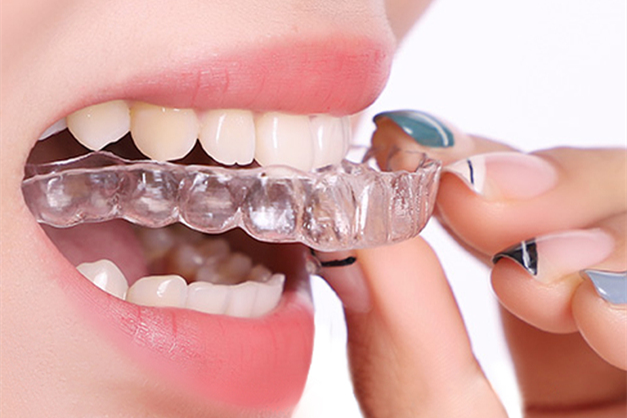 成人矫正牙齿的价格 成人牙齿正畸需要多久_牙齿矫正价格_牙齿矫正
